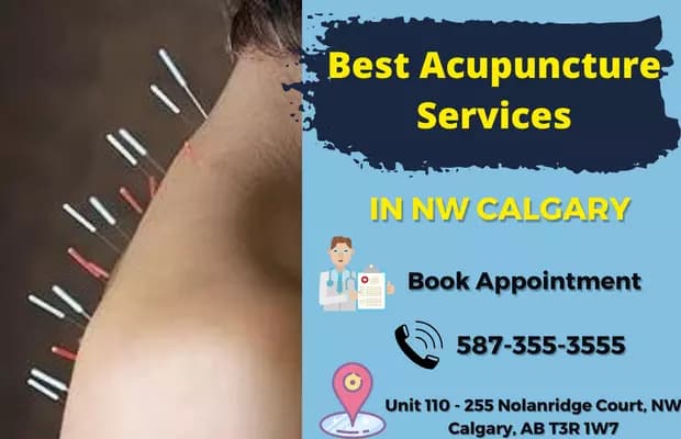 Acupuncture & Traditional Chinese Medicine in NW Calgary at Nolan Hill Physiotherapy & Massage NW Calgary