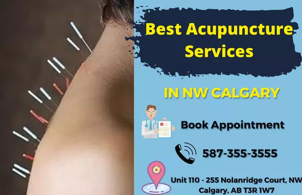 acupuncture services in Calgary