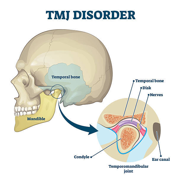 TMJ Treatment: Beyond Basic Jaw Exercises